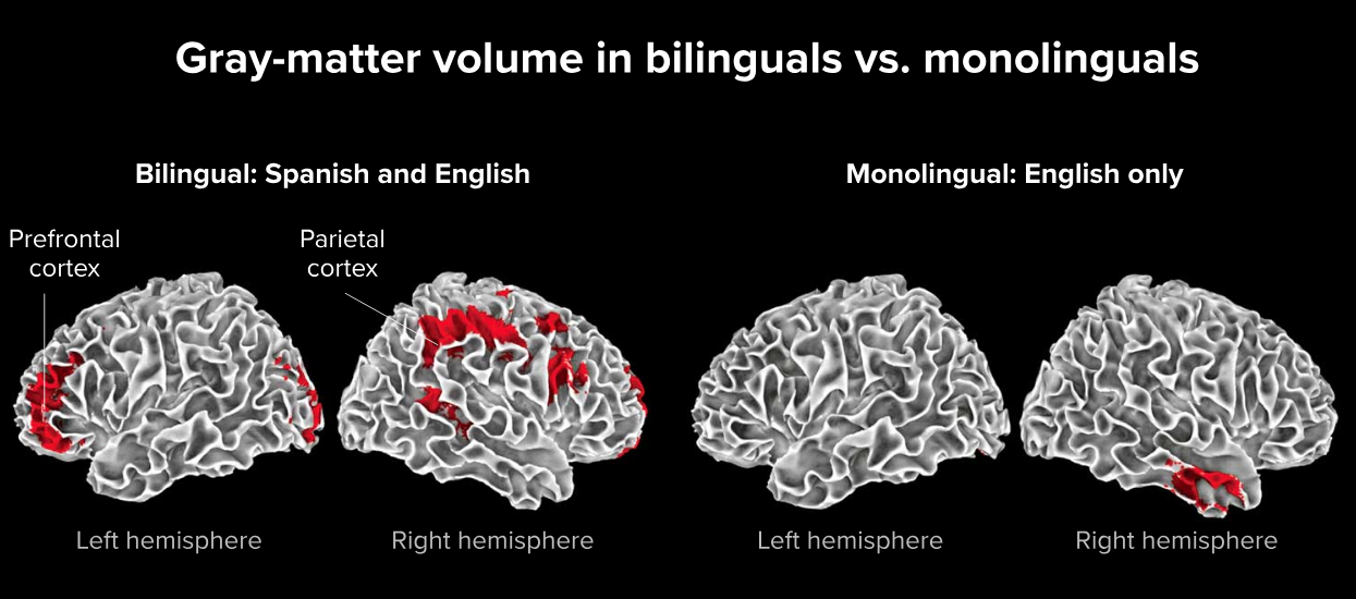 Gray matter volume in bilinguals vs. monolinguals